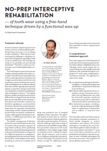 NO-PREP INTERCEPTIVE REHABILITATION — of tooth wear using a free-hand technique driven by a functional wax-up (EN)