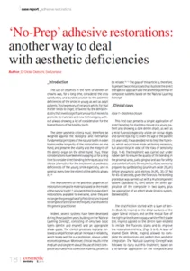 ‘No-Prep’ adhesive restorations: another way to deal with aesthetic deficiencies (EN)