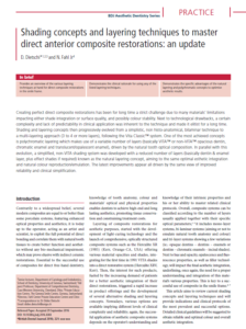 Shading concepts and layering techniques to master direct anterior composite restorations: an update (EN)
